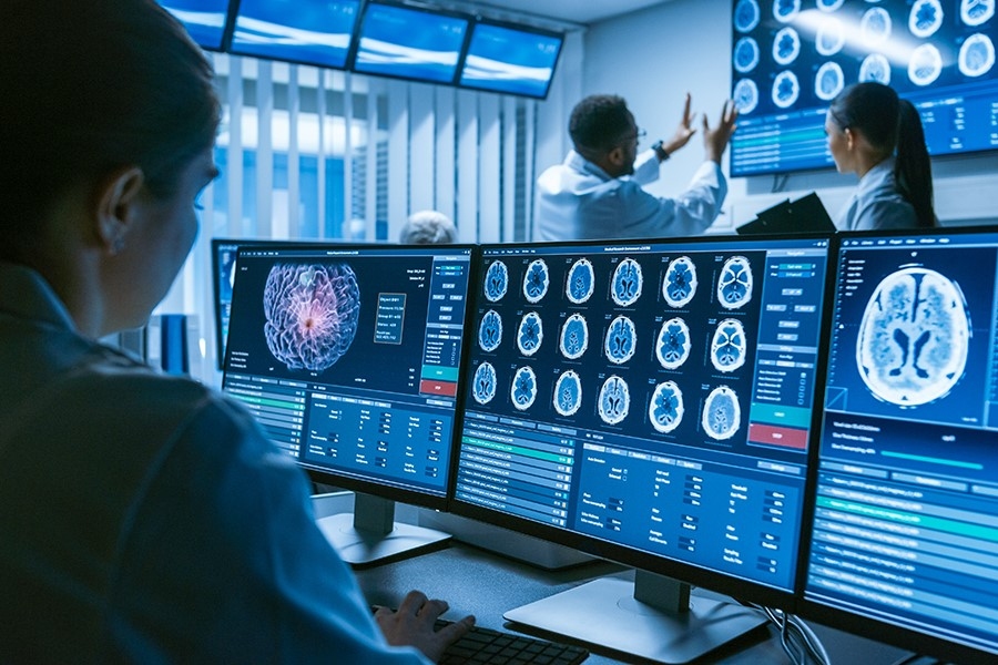 Photo of three desktop monitors displaying brain scans, with people in the background examining more scans on a wall-mounted monitor