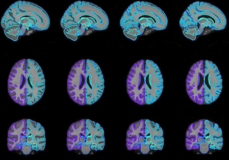 medical image analysis