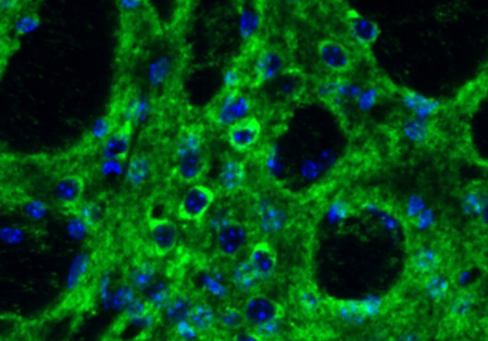 immune system molecule