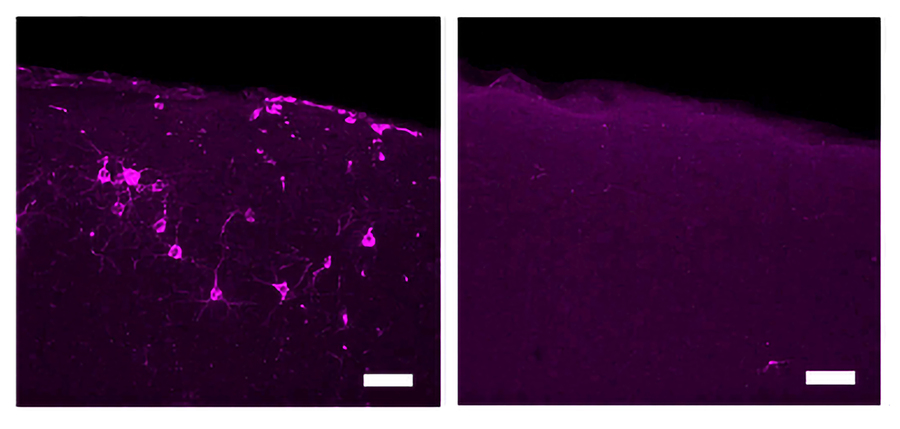 Alzheimer's disease protein phosphorylated tau 