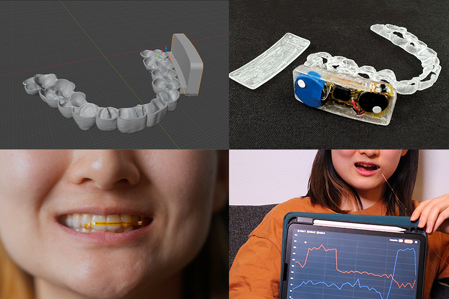 alt="A dental brace developed by researchers at MIT CSAIL and Aarhus University can be fabricated with sensors and feedback components to capture in-mouth interactions and data (Credits: Photos courtesy of Sebastian Krog Knudsen and the researchers)."