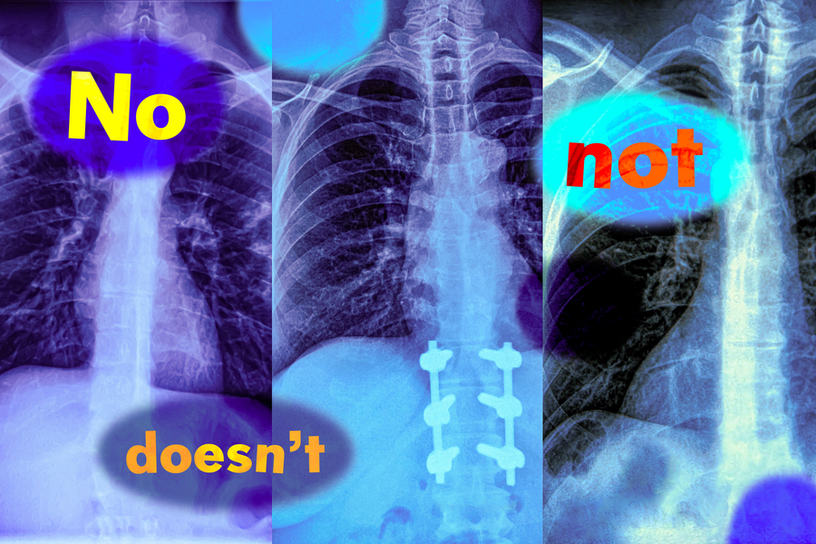 MIT researchers found that vision-language models, which are widely used to analyze medical images to streamline diagnosis, do not understand negation words like “no” and “not” (Credits: iStock; MIT News).