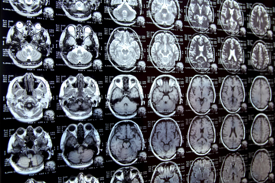 MIT researchers have developed a new AI-based tool that rapidly annotates areas of interest in medical images and can help in the study of new treatments or map disease progression (Credits: iStock).
