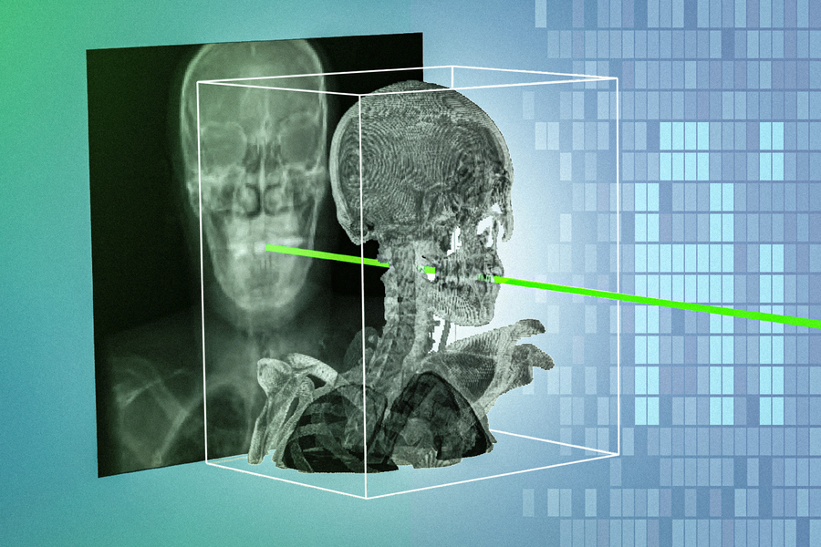 The new system uses an AI model that automatically matches one patient’s X-rays with 3D scans in a matter of seconds, and with sub-millimeter precision (Credits: Courtesy of the researchers; MIT News).